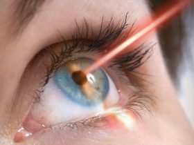 انواع روش های جراحی لیزر