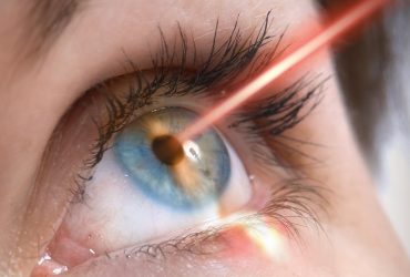 انواع روش های جراحی لیزر